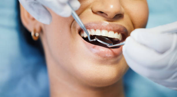 Best Emergency Dental Care for Broken or Chipped Teeth in Augusta, GA